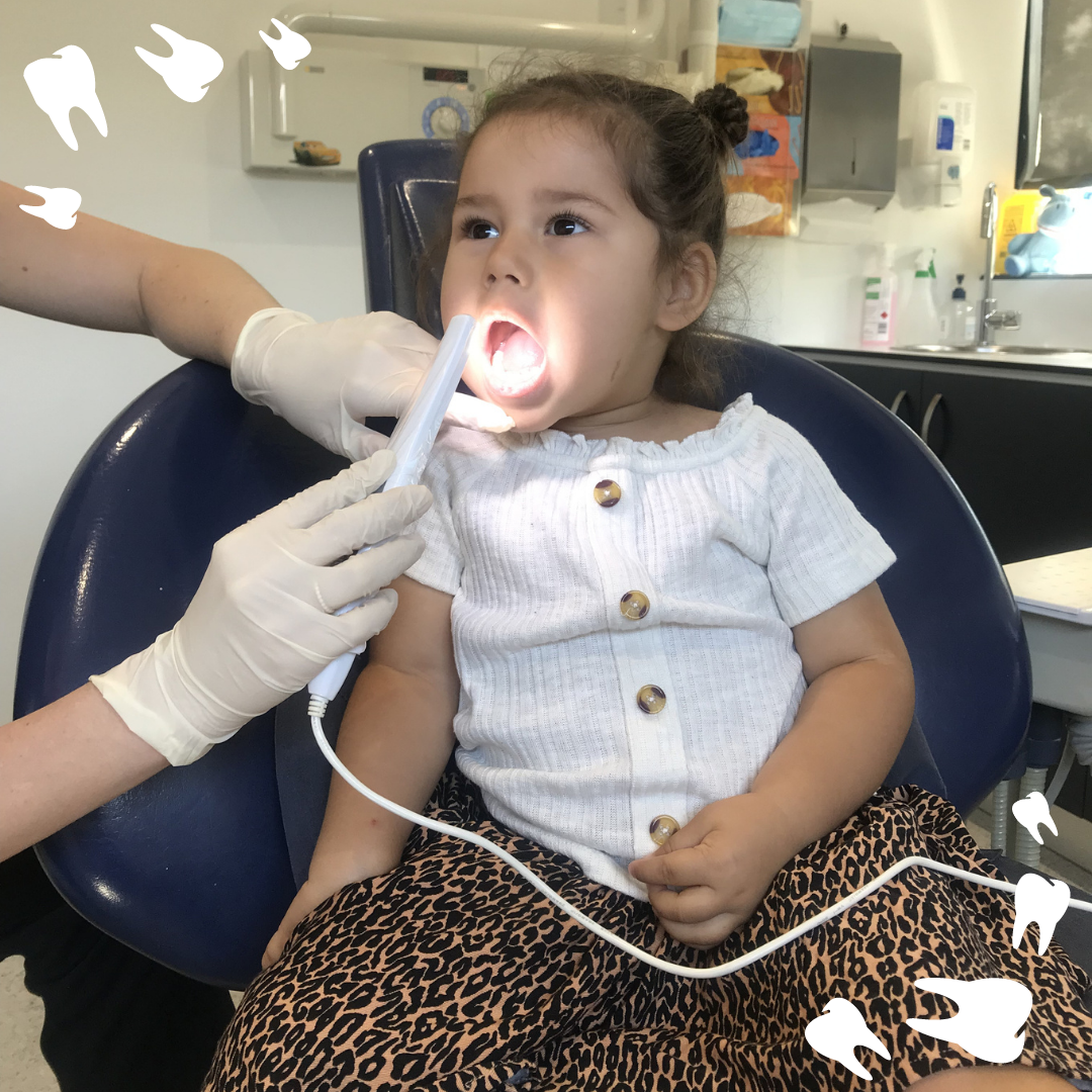 There are various types of tooth fillings that can be used on your child.